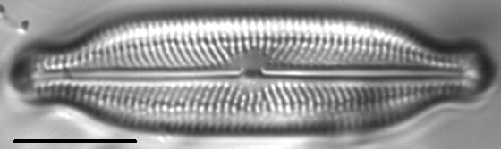 Neidiopsis wulffii LM2