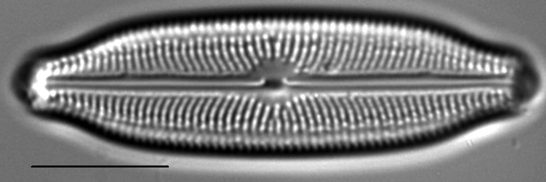 Neidiopsis wulffii LM1