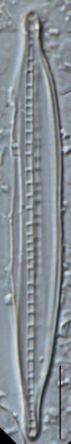 Nitzschia biacrula LM10