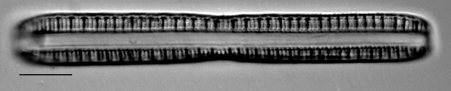 Nitzschia serpentiraphe LM2