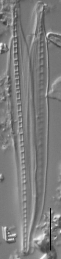 Nitzschia biacrula LM2