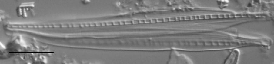 Nitzschia biacrula LM2