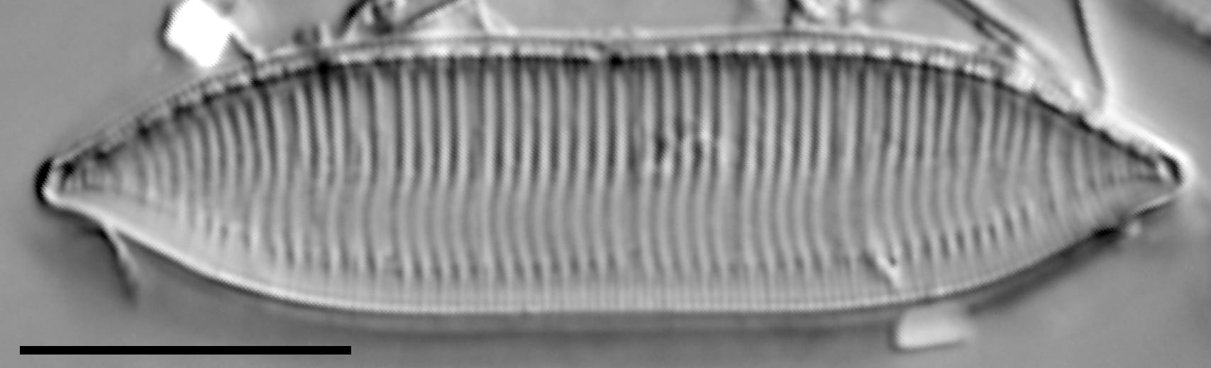 Tryblionella calida LM5