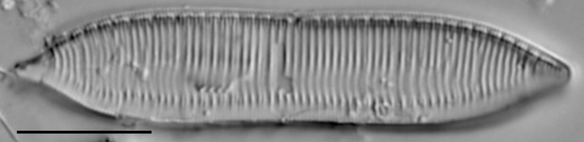 Tryblionella calida LM3