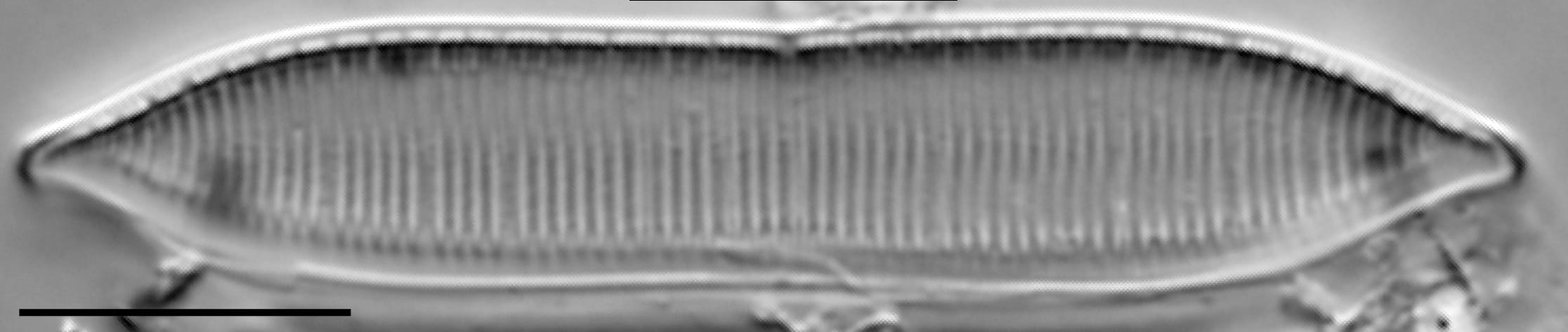 Tryblionella calida LM2