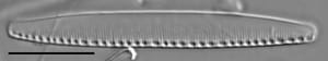 Nitzschia communis LM5