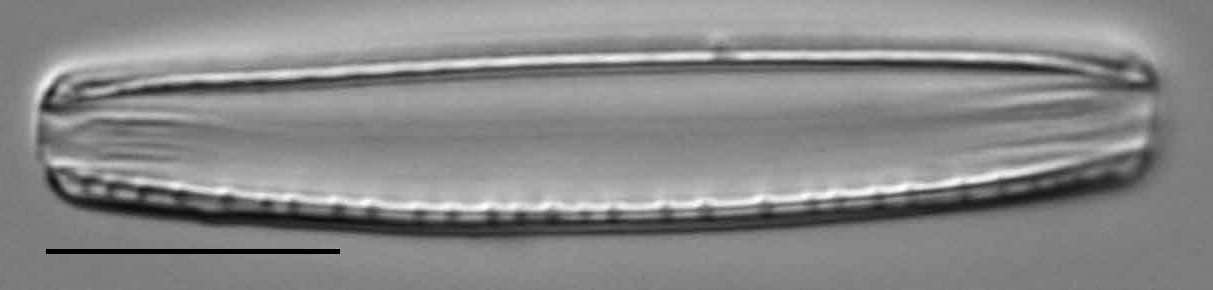 Nitzschia dissipata LM6