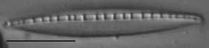Nitzschia dissipata LM5