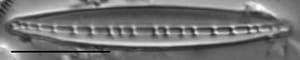Nitzschia dissipata LM3