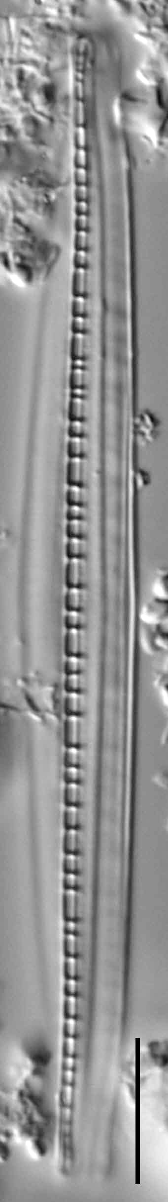 Nitzschia dissipata var media LM1