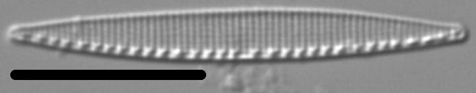 Nitzschia incognita LM4