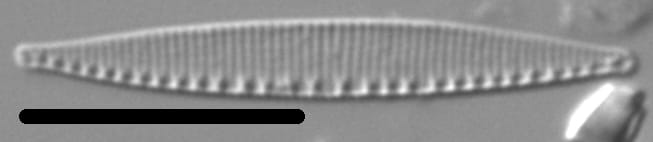 Nitzschia incognita LM2