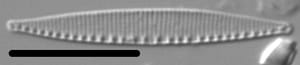 Nitzschia incognita LM2