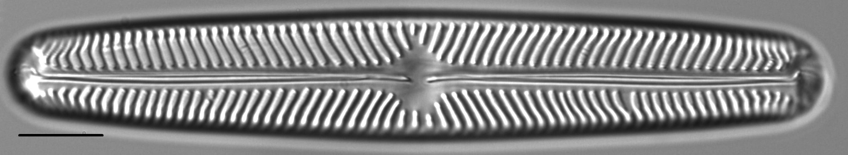 Navicula oblonga LM2