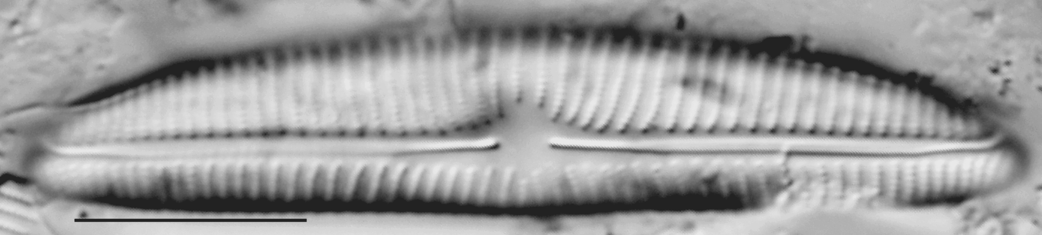 Encyonema norvegicum LM7