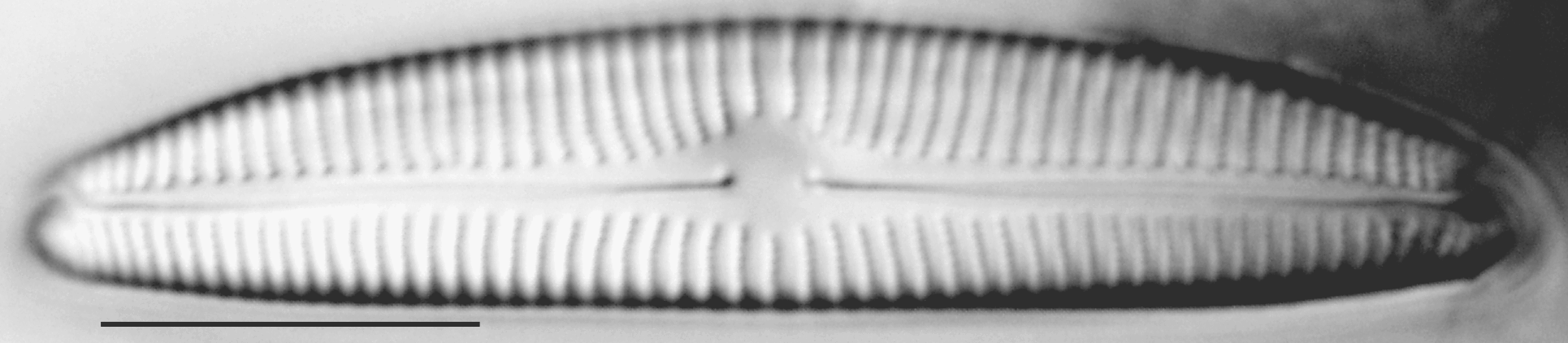 Encyonema norvegicum LM6