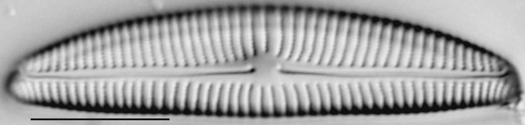 Encyonema norvegicum LM5