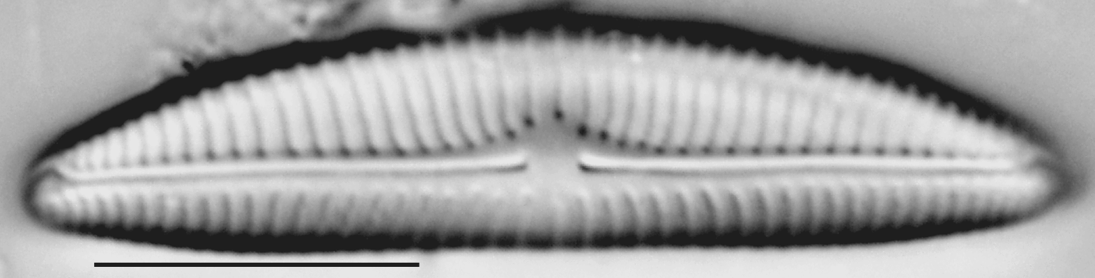 Encyonema norvegicum LM3