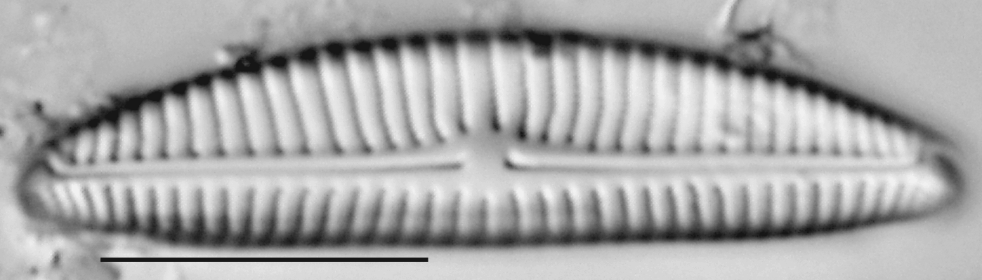 Encyonema norvegicum LM2