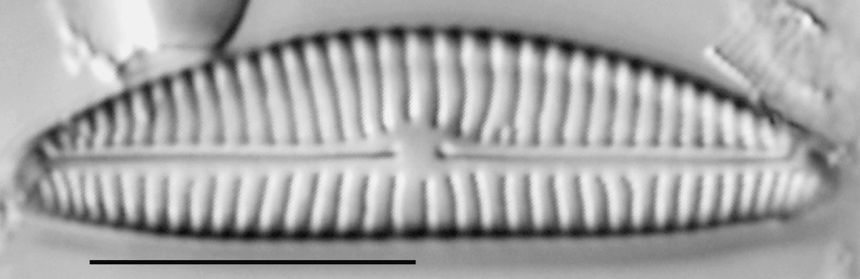 Encyonema norvegicum LM1