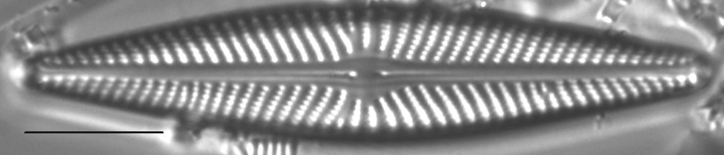 Navicula pseudolanceolata LM5
