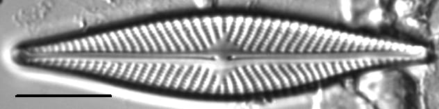 Navicula subconcentrica LM2