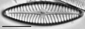 Navicula weberi LM5