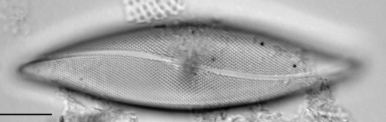 Pleurosigma inflatum LM5