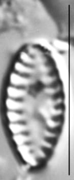 Pseudostaurosira elliptica LM6