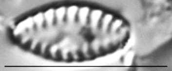 Pseudostaurosira elliptica LM6