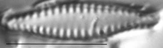 Pseudostaurosira elliptica LM5