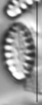 Pseudostaurosira elliptica LM4