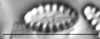 Pseudostaurosira elliptica LM4