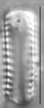 Pseudostaurosira elliptica LM3