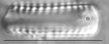 Pseudostaurosira elliptica LM3