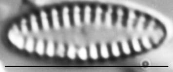 Pseudostaurosira elliptica LM2