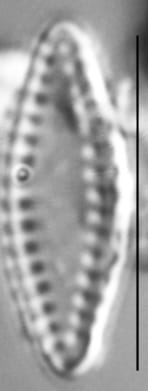 Pseudostaurosira elliptica LM1