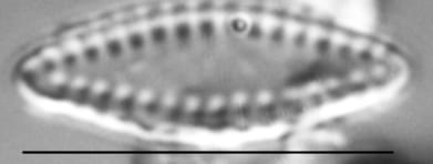 Pseudostaurosira elliptica LM1