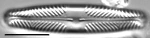 Pinnularia divergentissima LM5