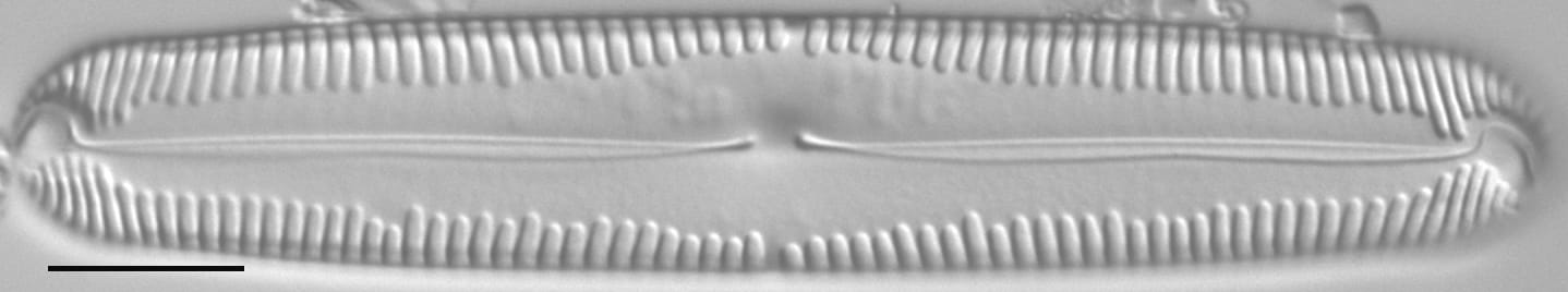 Pinnularia lokana LM1