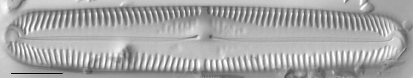 Pinnularia lokana LM2