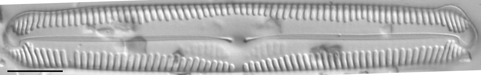 Pinnularia lokana LM3