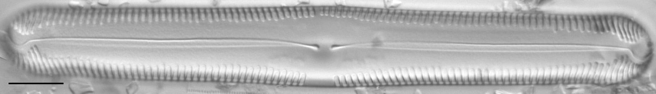 Pinnularia lokana LM4