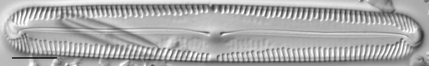 Pinnularia lokana LM5