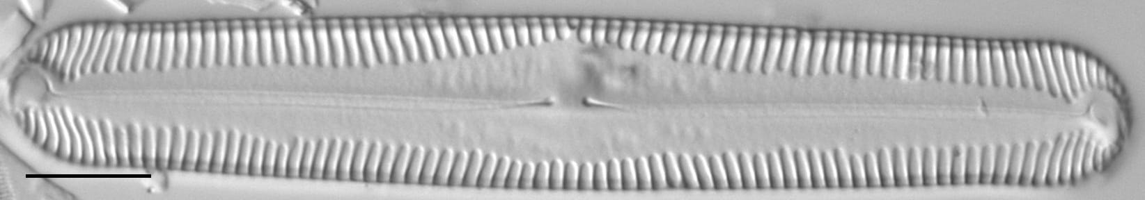 Pinnularia lokana LM6