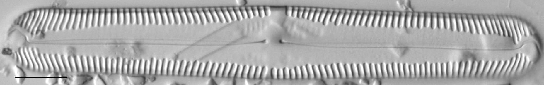 Pinnularia lokana LM7