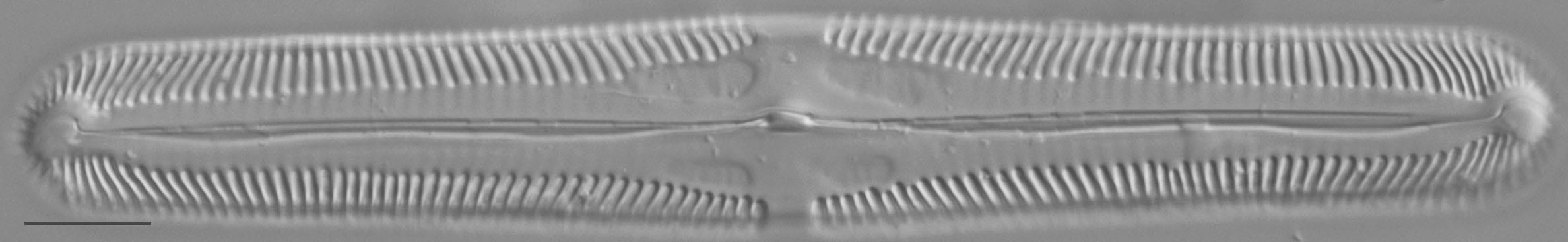 Pinnularia macilenta LM6