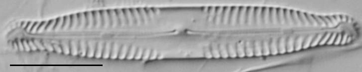 Pinnularia subcapitata var elongata LM2