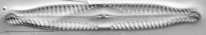 Pinnularia subcapitata var elongata LM3