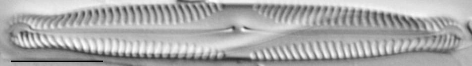 Pinnularia subcapitata var elongata LM5